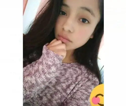 El estado de salud de Yamila Natalia Casa Peña es grave. Ella fue baleada por sicarios en una agencia de transportes de Trujillo.