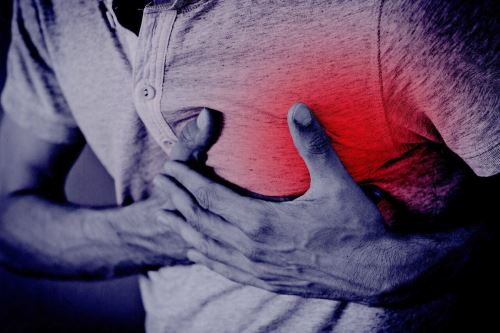 Un infarto al miocardio o ataque al corazón sucede cuando el flujo de sangre del corazón se bloquea, generalmente por un coágulo. Foto: Cortesía