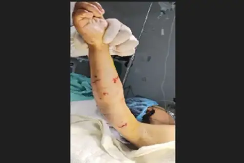 El inciso a) del artículo 14 de la Ley 27596 establece que si un can ocasiona lesiones graves a una persona, el dueño estará obligado a cubrir el costo total de la hospitalización, medicamentos y cirugías reconstructivas necesarias, hasta su recuperación total, sin perjuicio de la indemnización por daños y perjuicios que diera lugar.