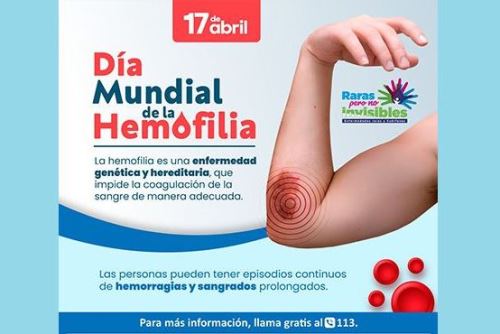 Día Mundial de la Hemofilia: aproximadamente 3,400 peruanos sufren de esta enfermedad. Foto: ANDINA/Difusión.