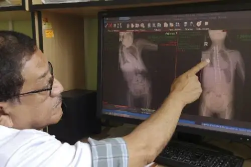 El año pasado se realizaron 28 de estas operaciones. Foto: ANDINA/Difusión