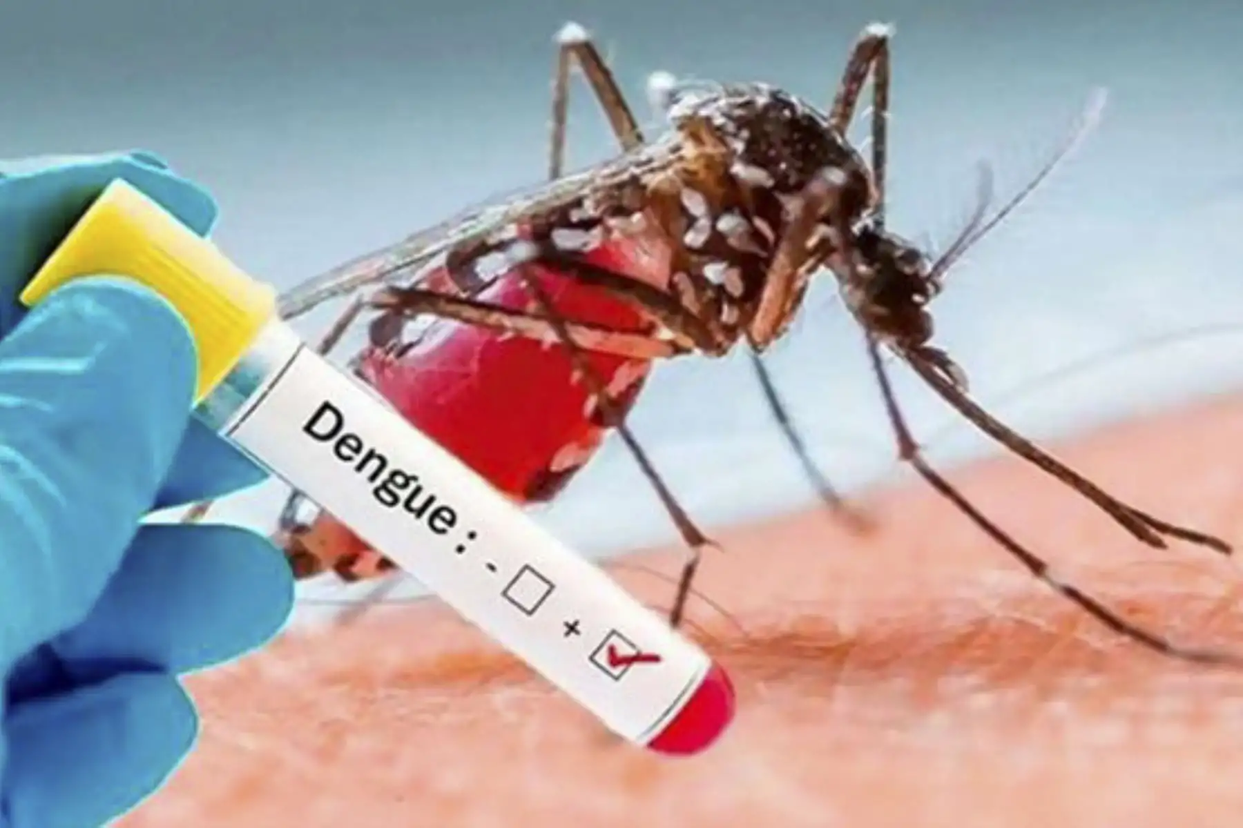 Los establecimientos de salud cuentan con diferentes tipos de pruebas de descarte para dengue. Foto: ANDINA/Minsa