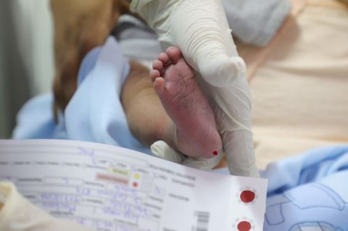 Pruebas de tamizaje neonatal alcanzaron el 85 % de cobertura a nivel nacional. Foto: ANDINA/Difusión.