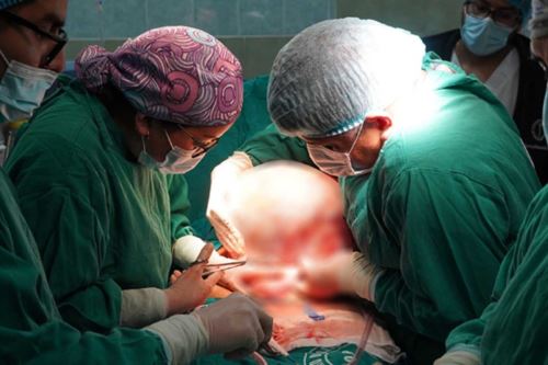 Cirujanos del hospital Hipólito Unanue extraen tumor de 10 kg en exitosa operación. Foto: ANDINA/difusión.