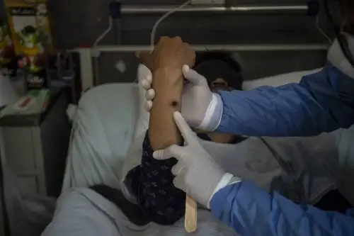 Esta es la segunda vez, en un lapso de dos años, que dicha enfermedad infecciosa pasa a convertirse en una amenaza sanitaria internacional. Foto: AFP