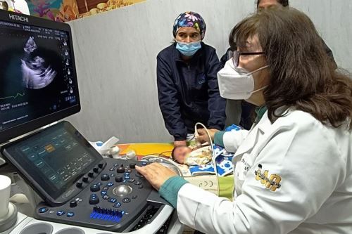 INSN-Breña: más de 500 menores con problemas cardíacos reciben atención. Foto: ANDINA/Difusión.