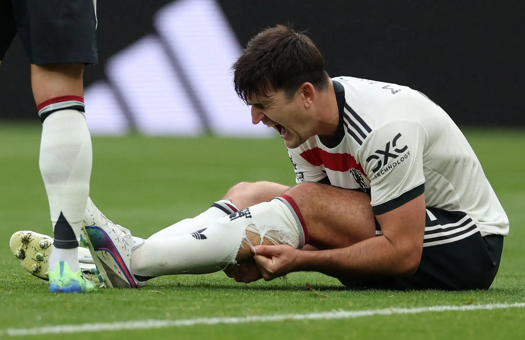 El defensor inglés del Manchester United Harry Maguire sostiene su pantorrilla mientras se sienta en el campo herido durante el partido de fútbol de la Premier League inglesa entre Aston Villa y Manchester United. AFP