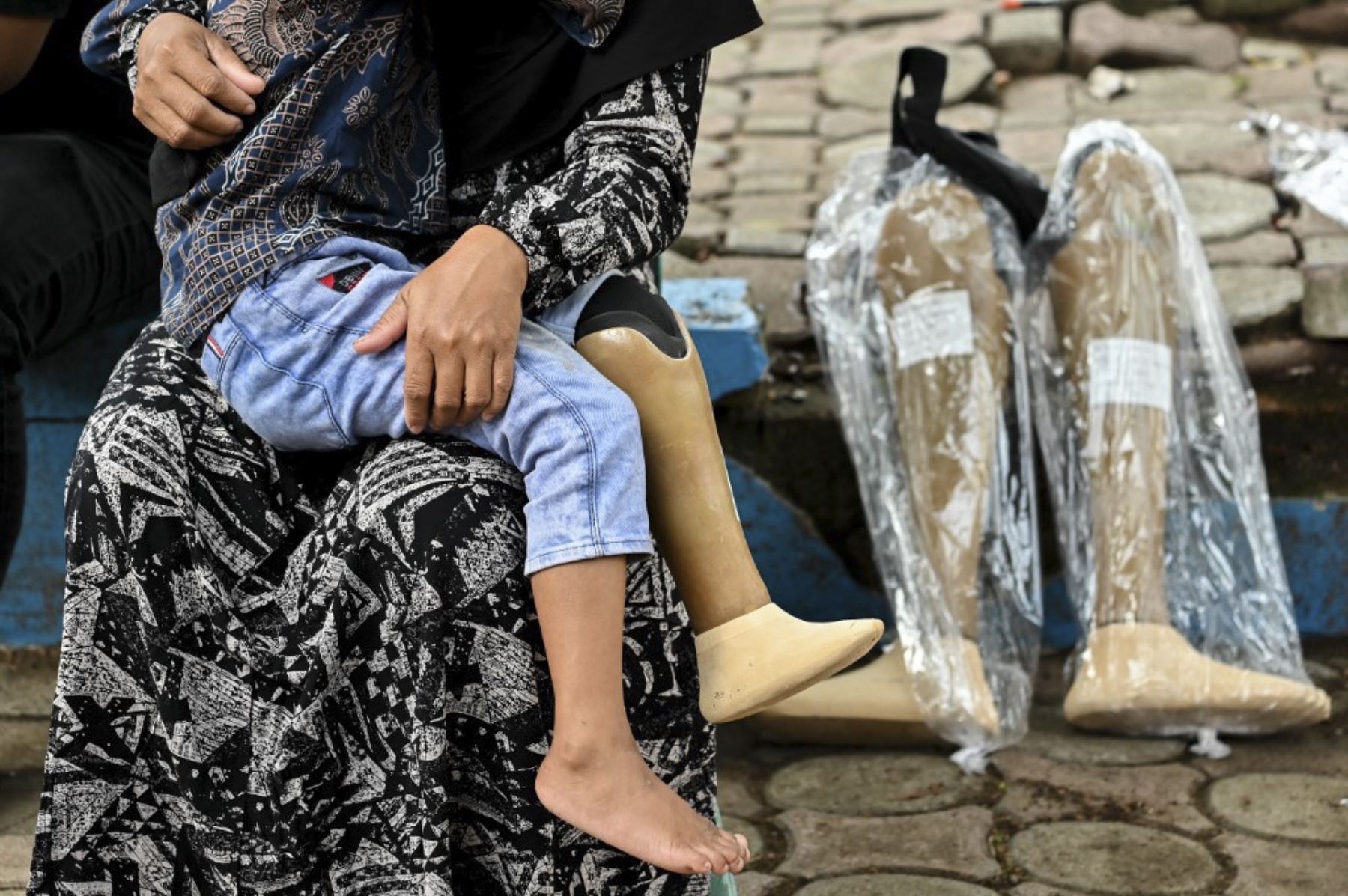 Una mujer sostiene a su hijo mientras esperan recibir una prótesis donada por el gobierno indonesio para conmemorar el Día Internacional de las Personas con Discapacidad en Banda Aceh el 3 de diciembre de 2024. (Foto de CHAIDEER MAHYUDDIN / AFP)