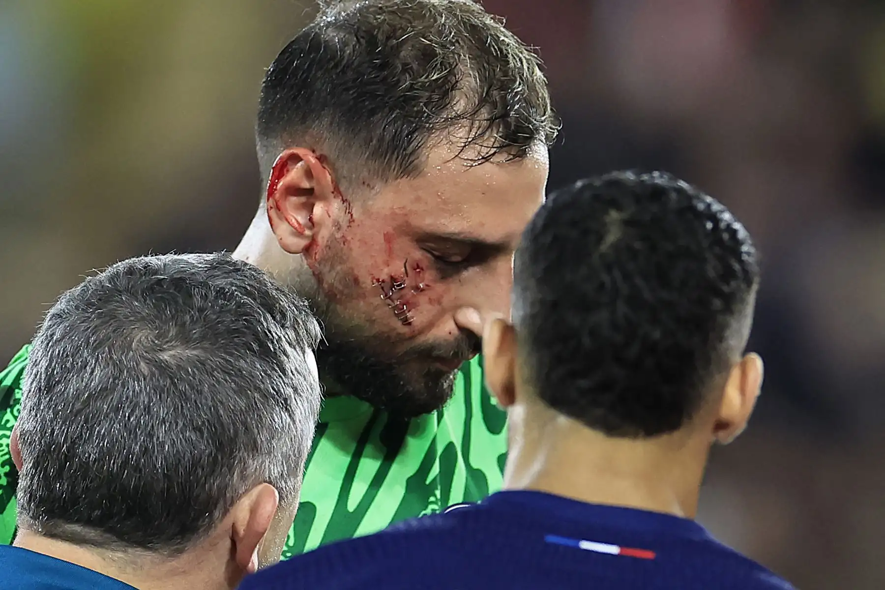 El portero italiano del Paris Saint-Germain  Gianluigi Donnarumma  recibe ayuda médica después de sufrir una lesión durante el partido de fútbol francés L1 entre el AS Monaco y el Paris Saint-Germain. AFP