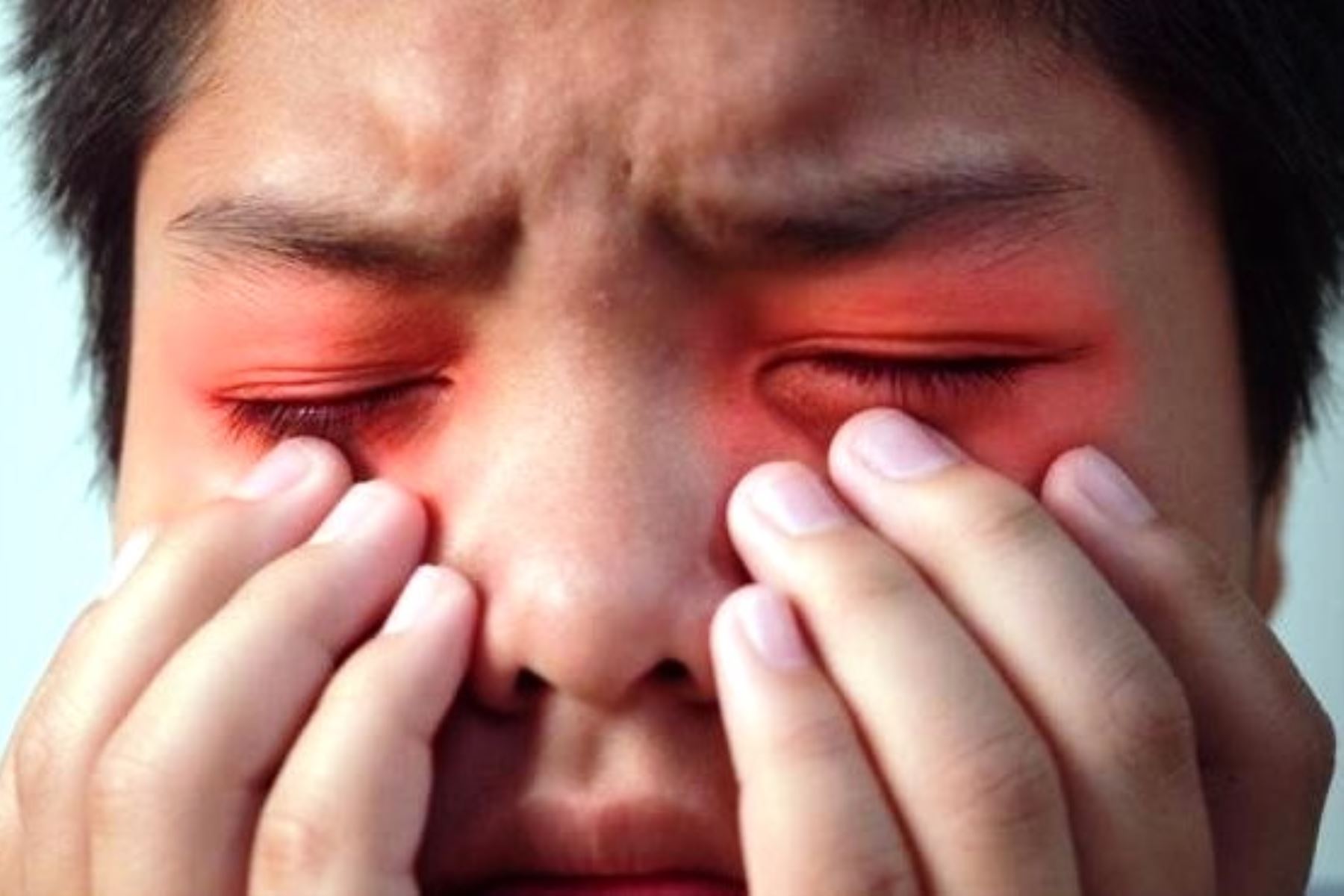 ¡Cuidado! Frotarse los ojos podría causar irritación, infecciones y daños a la córnea. Foto: ANDINA/Difusión.