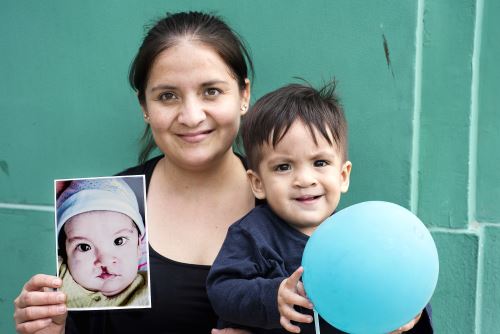 El sorteo se realizará el 27 de marzo en el Facebook oficial de Operación Sonrisa Perú. Cortesía.