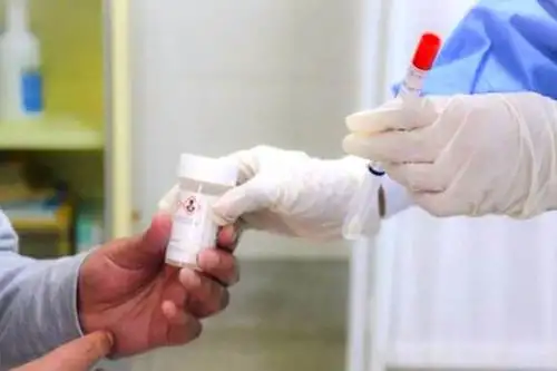 En 10 minutos se puede detectar el cáncer de cuello uterino con simple prueba autotoma. Foto: ANDINA/Difusión.