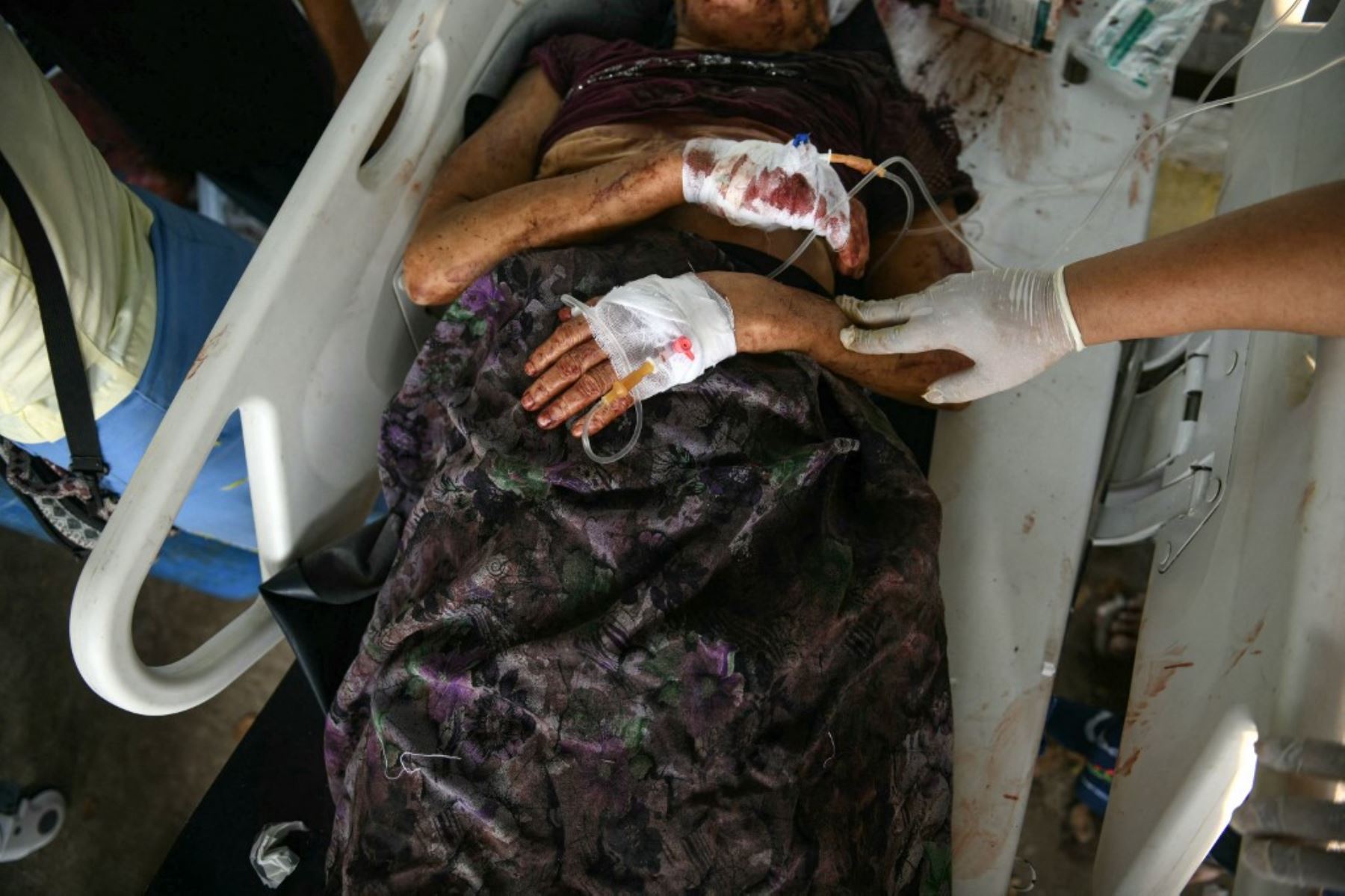 Un superviviente del terremoto es trasladado al recinto de un hospital en Naipyidó el 28 de marzo de 2025, tras un terremoto en el centro de Myanmar. Un potente terremoto sacudió el centro de Myanmar. Foto: AFP