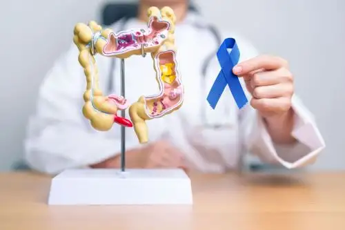 Lima es la ciudad con más casos con 269 afectados de cáncer colorrectal. Foto: Difusión