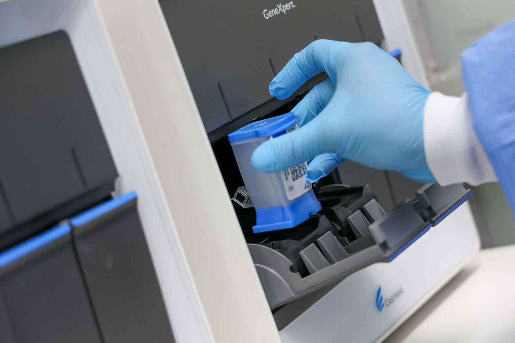El procedimiento, evaluado y aprobado por el Laboratorio de Referencia Nacional de Micobacterias del Centro Nacional de Salud Pública del Instituto Nacional de Salud, garantiza altos estándares de calidad, bioseguridad y precisión diagnóstica.ANDINA/Difusión