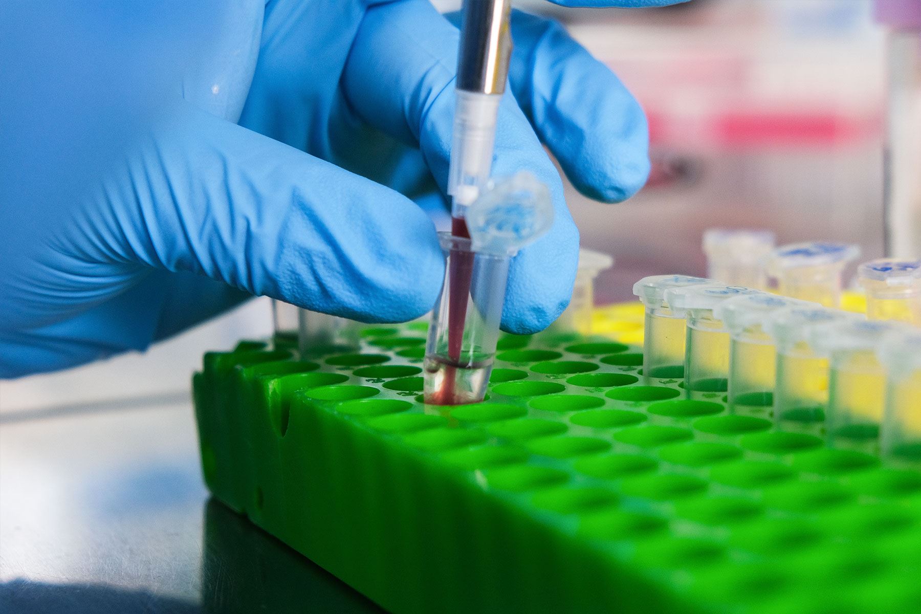 El proceso comienza con la toma de una muestra de sangre del paciente. El siguiente paso es hacer la extracción del material genético, específicamente de las zonas que están relacionadas con el cáncer. Fotos: Carlos Marín/ ANDINA