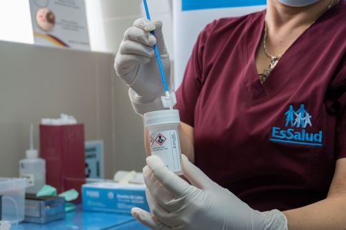 Red Sabogal de EsSalud implementa pruebas moleculares para detectar cáncer de cuello uterino. Foto: ANDINA/Difusión