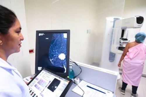 Minsa: más de 10,000 tamizajes de cáncer de mama se realizaron en lo que va del 2025. Foto: ANDINA/Difusión.