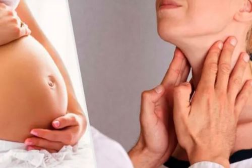Tiroides en mujeres gestantes o embarazadas. Foto: ANDINA/Difusión