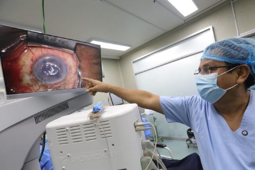El Minsa da un paso importante hacia la modernización del equipamiento del centro quirúrgico del Instituto Nacional de Oftalmología con la entrega de cinco microscopios de alta gama. Foto: INO