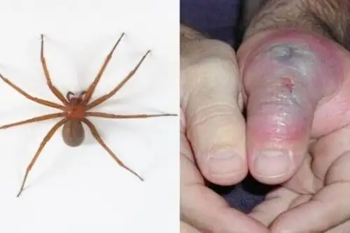 INS advierte aumento de mordeduras de araña casera durante el invierno. Foto: ANDINA/Difusión.