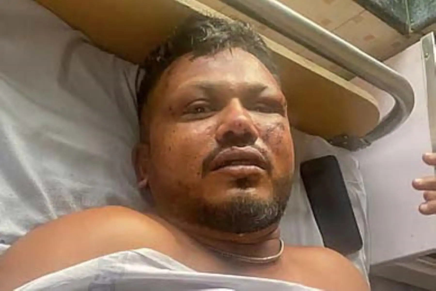 La magnitud de la tragedia fue tal que las autoridades locales se vieron obligadas a iniciar un proceso de identificación mediante pruebas de ADN debido al estado de los cuerpos tras la explosión y el incendio. Foto: ANDINA/AFP