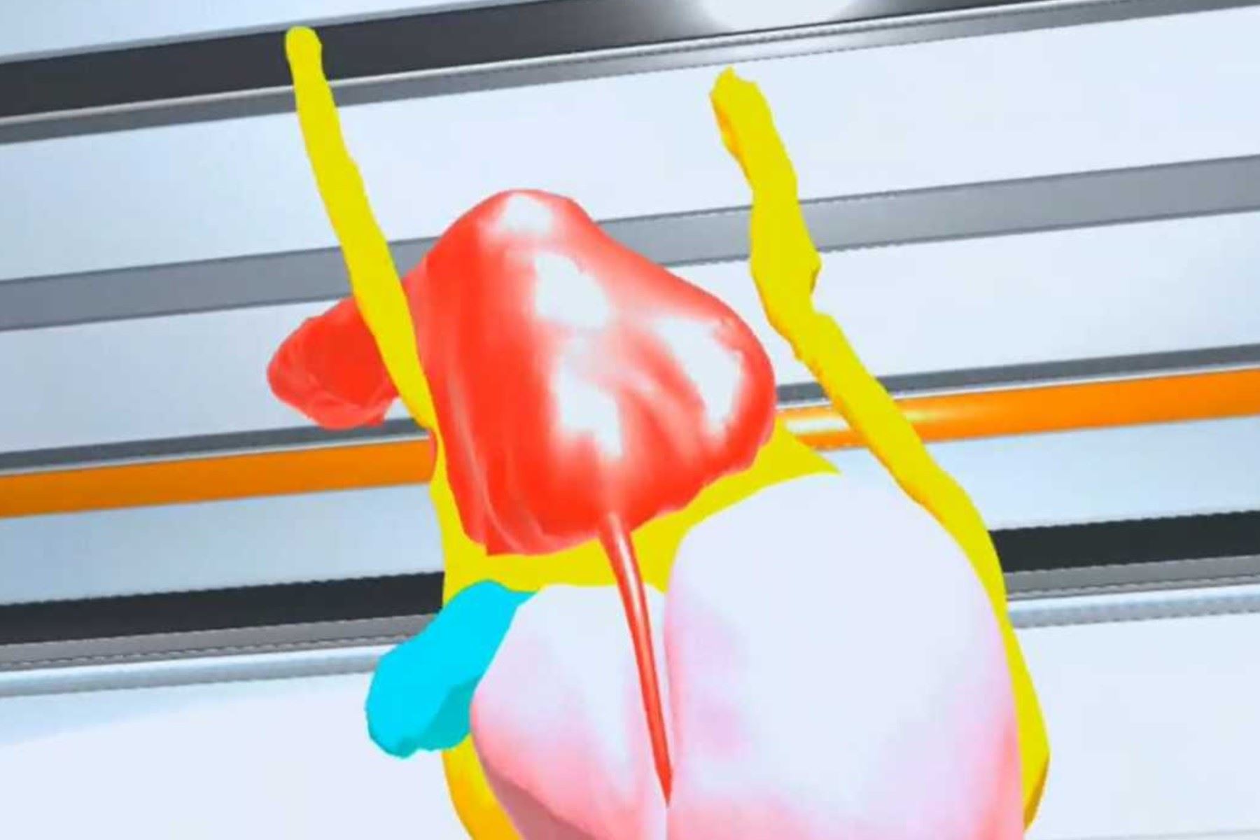 El modelado 3D para planificación quirúrgica es un proceso meticuloso que transforma imágenes médicas (como resonancias o tomografías) en modelos digitales tridimensionales de la anatomía del paciente.