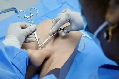 Minsa: 1,500 hombres se inscriben para proceso de vasectomía en 3 hospitales de Lima. Foto: ANDINA/Difusión.