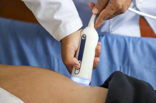 El hospital Reblagliati realizó pruebas con el equipo FibroScan, que reemplaza en gran medida a la biopsia hepática, y encontró que más de 1200 pacientes tenía daño hepático. Foto: ANDINA/Difusión