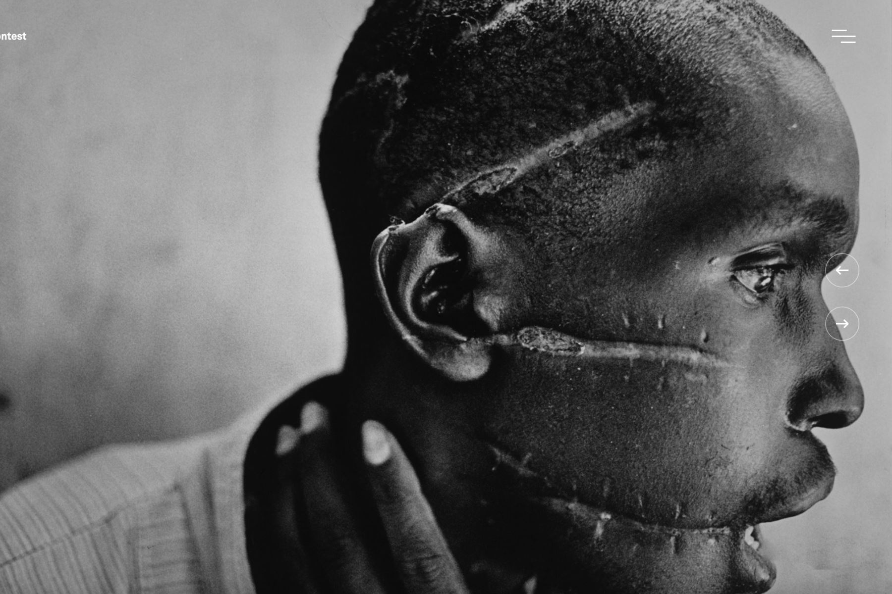 1 de junio de 1994

Un hombre hutu en un hospital de la Cruz Roja en Nyanza, Ruanda. La milicia hutu Interahamwe le mutiló el rostro, pues sospechaba que simpatizaba con los rebeldes tutsis. Foto: Word Press Photo (James Nachtwey)