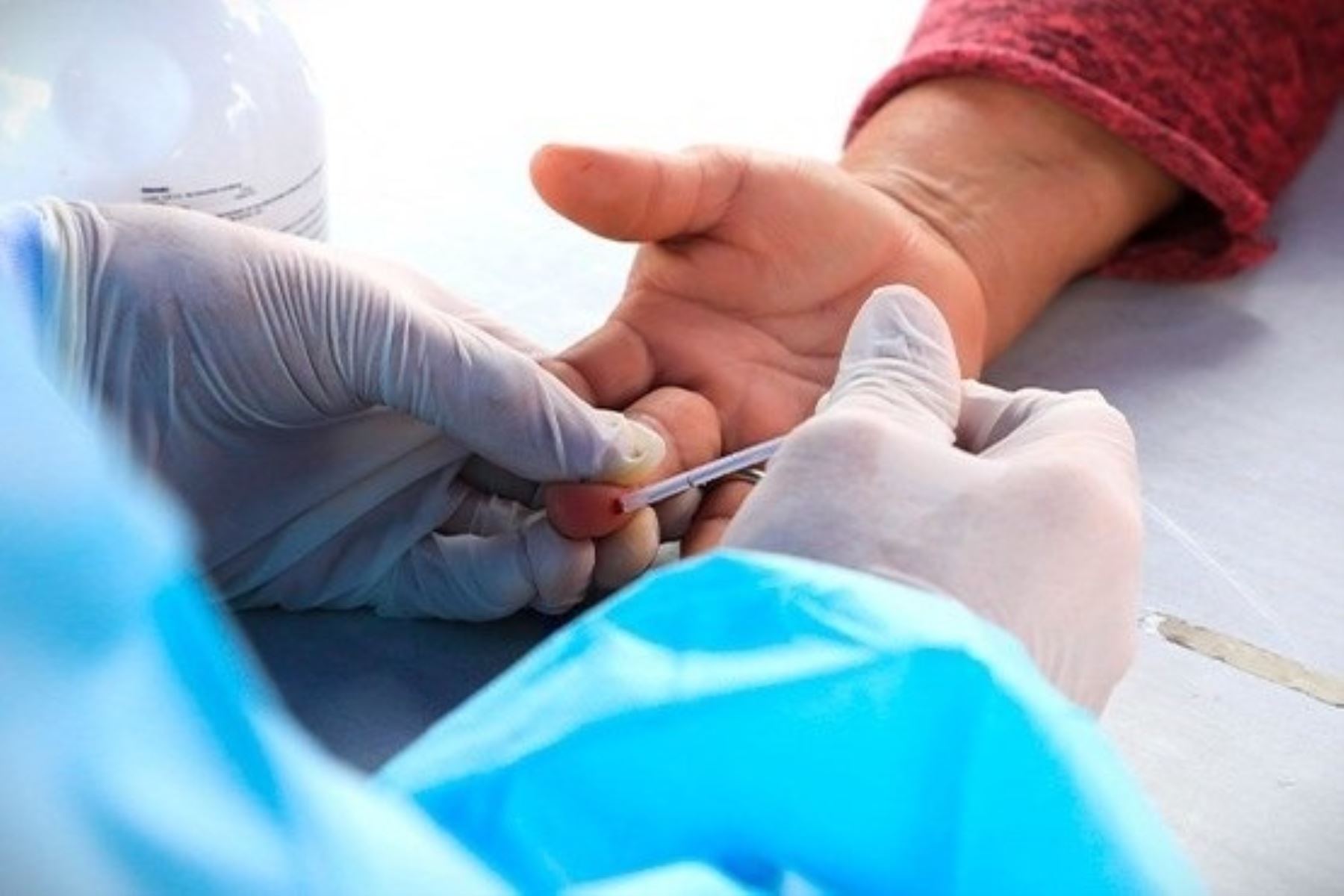 Sífilis: una infección de transmisión sexual prevenible y curable si se detecta a tiempo. Foto: ANDINA/Difusión.