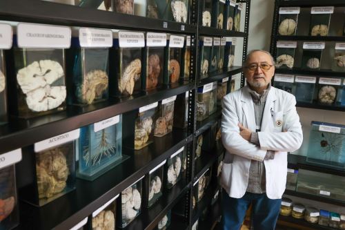 El doctor Carlos Alberto Escalante Gabancho, especialista en neurología y neuropediatría del Instituto Nacional de Ciencias Neurológicas (INCN). Fotos: ANDINA/Juan Carlos Guzmán