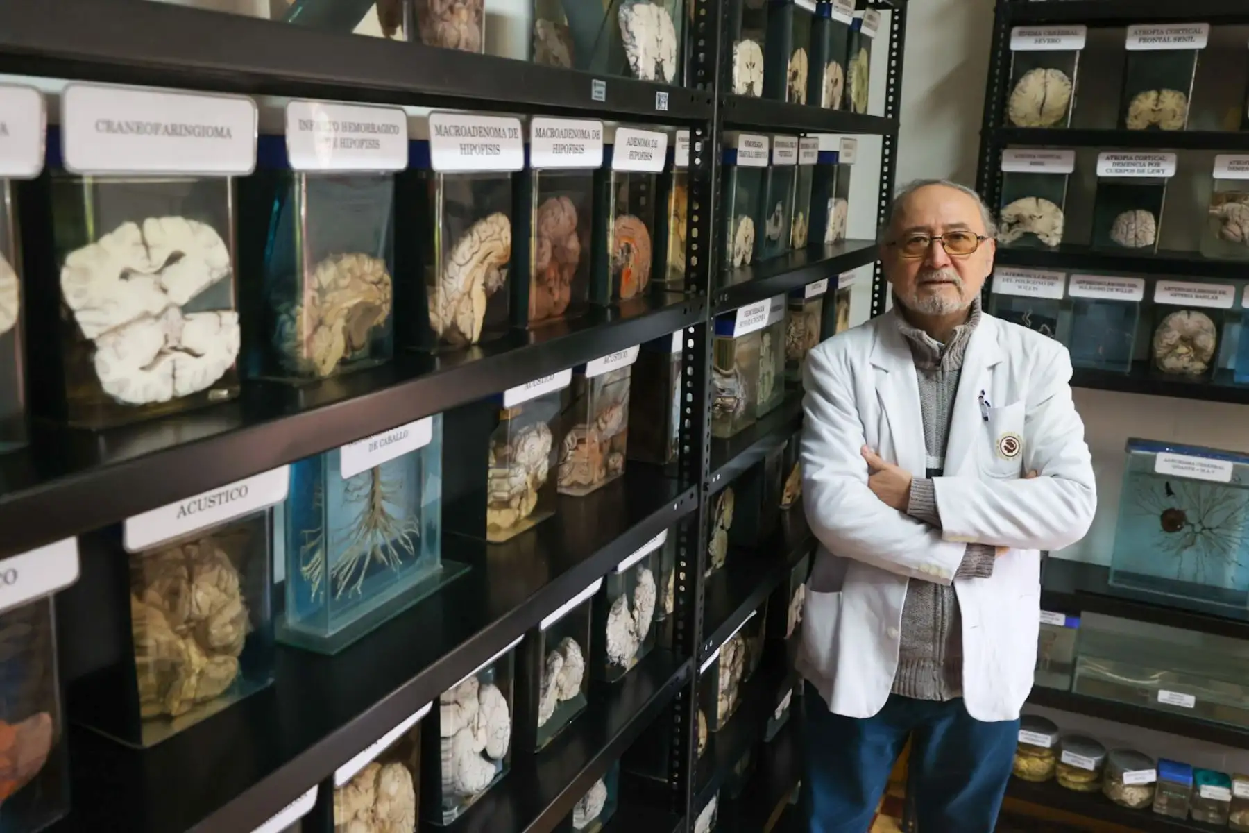 El doctor Carlos Alberto Escalante Gavancho, especialista en neurología y neuropediatría del Instituto Nacional de Ciencias Neurológicas (INCN). Fotos: ANDINA/Juan Carlos Guzmán