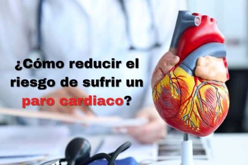 El paro cardiaco es la primera causa de muerte en el mundo y, en el caso peruano, ocupa el segundo lugar después de la neumonía. Su principal causa es el infarto cardiaco, informó el Dr. Rubén Azañero, cardiólogo del Hospital Nacional Dos de Mayo. Foto: ANDINA/Difusión