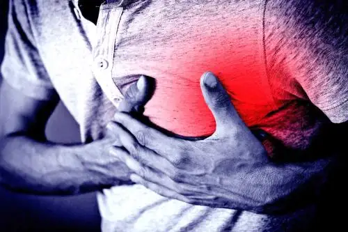El paro cardiaco es la primera causa de muerte en el mundo y, en el caso peruano, ocupa el segundo lugar después de la neumonía. Su principal causa es el infarto cardiaco, informó el Dr. Rubén Azañero, cardiólogo del Hospital Nacional Dos de Mayo. Foto: ANDINA/Difusión