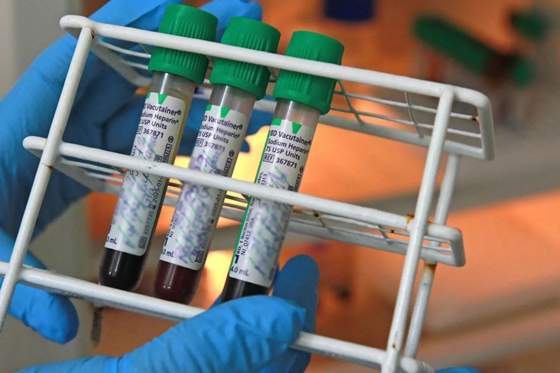La bioinformática es clave en la ciencia: gracias a la inteligencia artificial, hoy se puede predecir la estructura de casi todas las proteínas humanas.