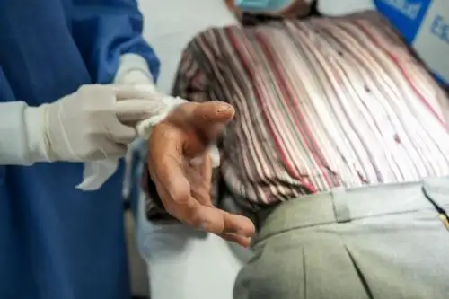 Paciente asegurado de 66 años sufrió accidente y terminó cortándose un dedo de la mano. Tras un exitoso autotrasplante de dedo del pie, consiguió recuperar la funcionalidad de su mano. Foto: ANDINA/Difusión