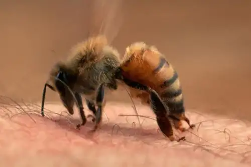 Instituto Nacional de Salud advierte sobre riesgos por picaduras de abejas. Foto: ANDINA/Difusión