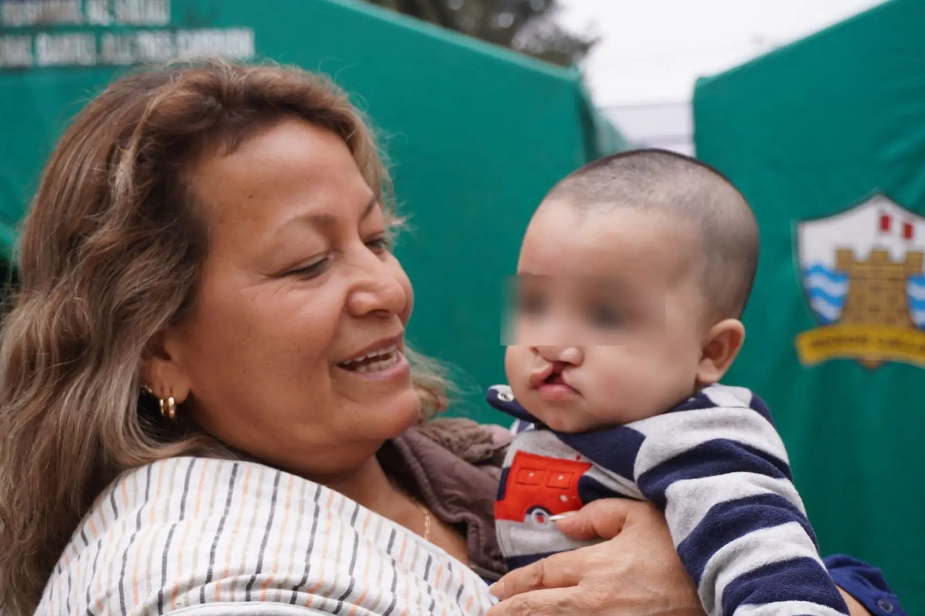 INSN-Breña lanza campaña nacional para realizar 80 cirugías gratuitas de paladar hendido