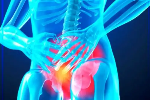 Solo el 15 % de los casos de cáncer de próstata que llegan al INEN se detecta a tiempo. Foto: ANDINA/Difusión.