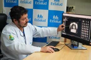 La intervención, que duró cerca de cuatro horas, consistió en retirar la parte afectada de la tráquea y reconstruirla con tejido sano. Durante la cirugía se utilizaron técnicas avanzadas de ventilación directa. Foto: ANDINA/Difusión