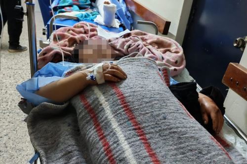 El Hospital Honorio Delgado de Arequipa recibió a cuatro de los nueve pasajeros heridos de gravedad del bus interprovincial que cayó a un abismo en el km 781 de la Panamericana Sur, en Arequipa. ANDINA/Difusión