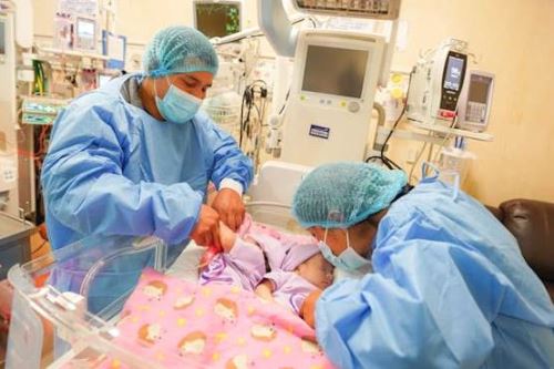 Minsa: pequeñas siamesas prematuras se preparan para futura cirugía de separación. Foto: ANDINA/Difusión.