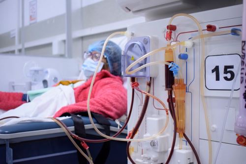 Minsa y Perú Compras proponen cambios para elevar calidad del servicio de hemodiálisis. Foto: ANDINA/Difusión