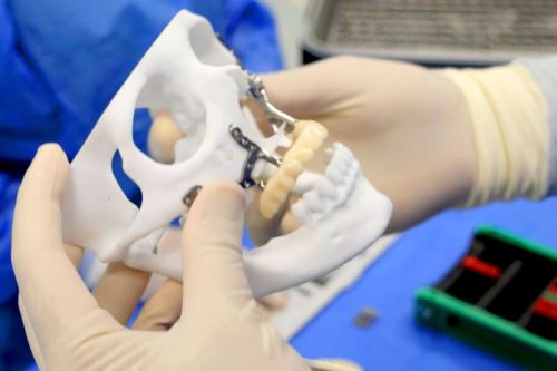 INEN realiza primera cirugía en Perú con Implantes Subperiósticos Personalizados 3D para reconstrucción maxilofacial en pacientes con cáncer. Foto: ANDINA/Difusión