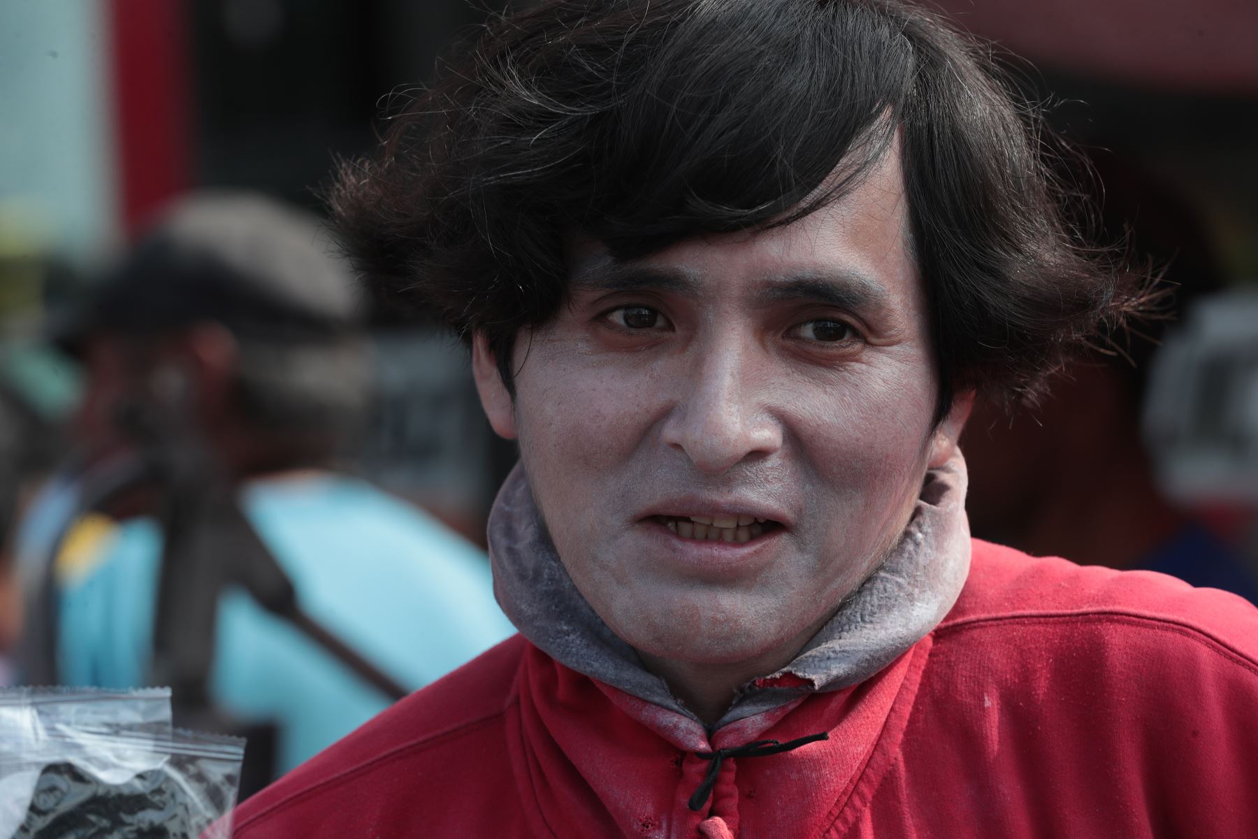 Especialistas advierten que una exposición prolongada sin protección puede provocar quemaduras solares, envejecimiento prematuro de la piel y aumentar el riesgo de cáncer cutáneo.
Foto:ANDINA/Verónica Calderón Zúñiga