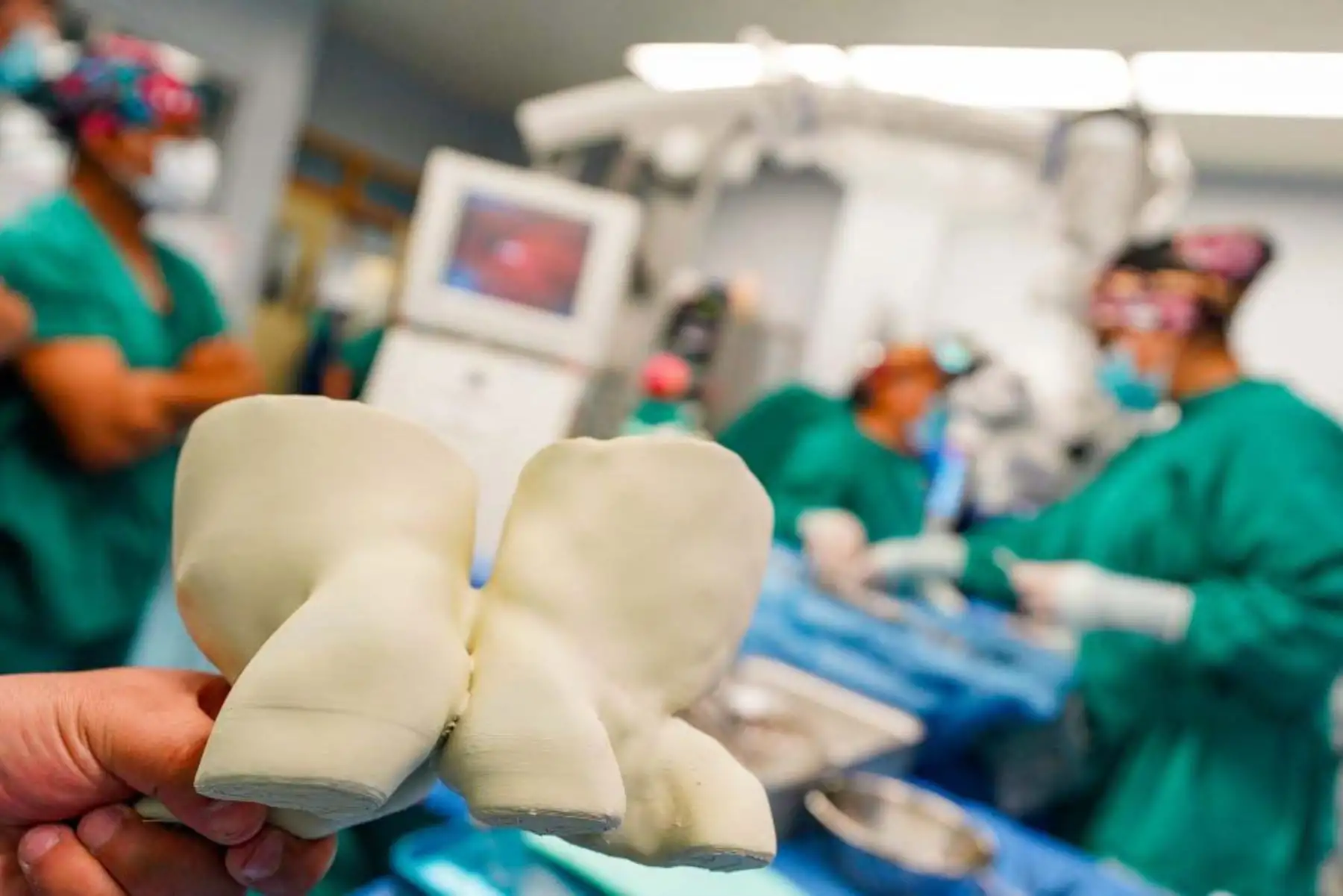 Tras la exitosa separación, las gemelas fueron trasladadas a la Unidad de Cuidados Intensivos de Neurocirugía, donde recibieron monitoreo permanente y atención especializada para su recuperación progresiva. Foto: ANDINA/Composición con fotos de Difusión