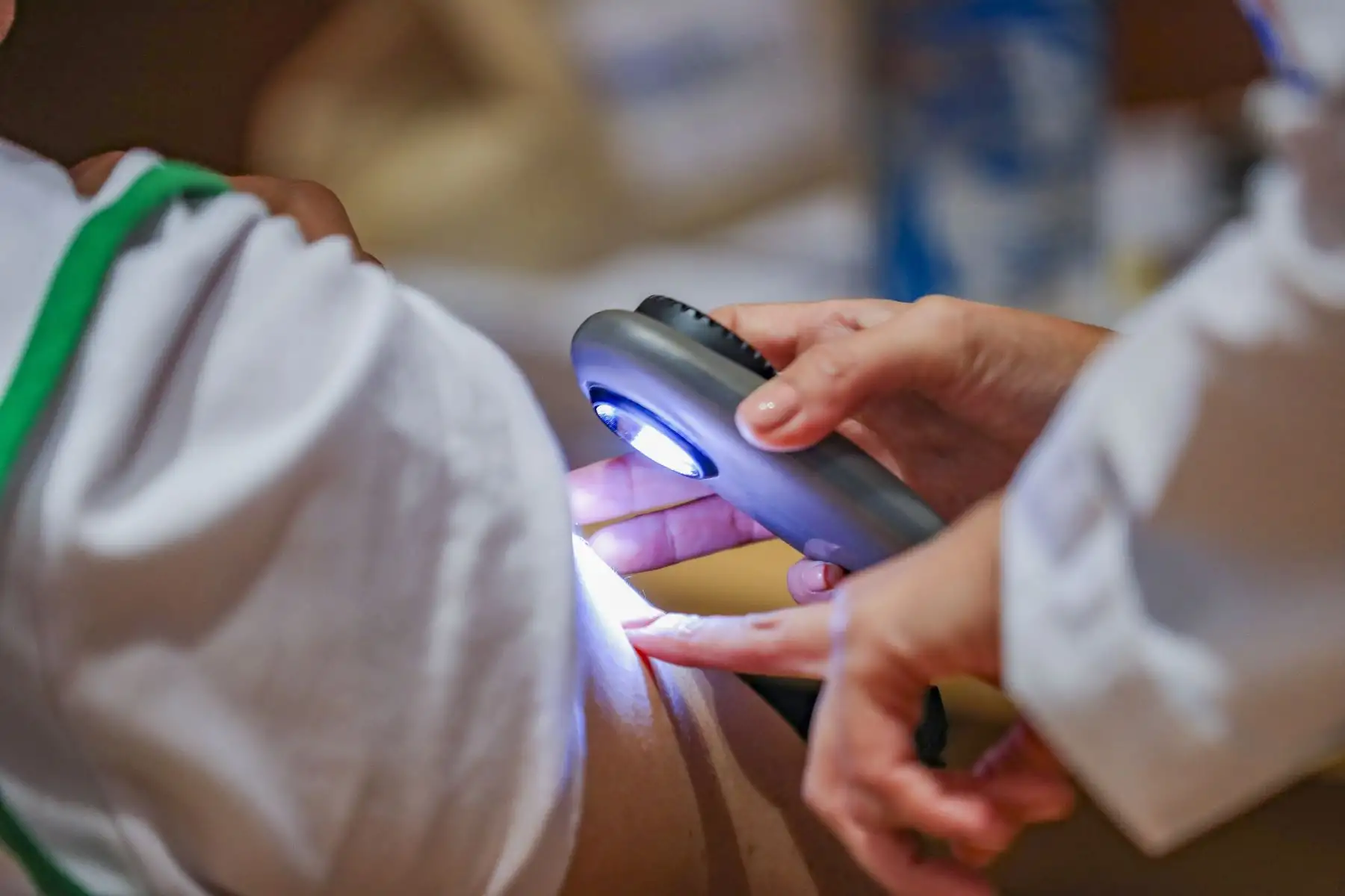 La clave está en la prevención. Durante la campaña organizada por el INSN San Borja, los dermatólogos enseñaron a los asistentes a aplicar la regla del ABCDE (Asimetría, Bordes, Color, Diámetro y Evolución) para examinar lunares y manchas, una herramienta vital para detectar posibles neoplasias en etapas tempranas. Foto: ANDINA/Ricardo Cuba