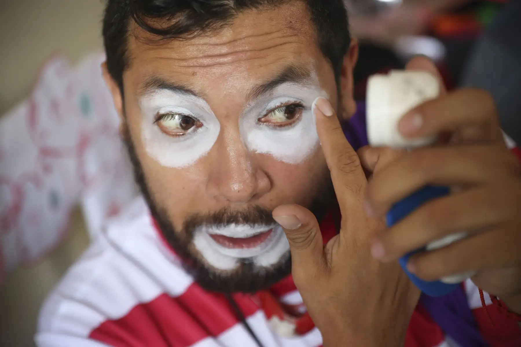 La visita forma parte de una jornada de Entre Payasos, asociación sin fines de lucro que desde hace 15 años promueve la terapia de la risa en distintos centros de salud, llevando alivio emocional a pacientes hospitalizados. Foto: ANDINA/Jhonel Rodríguez Robles