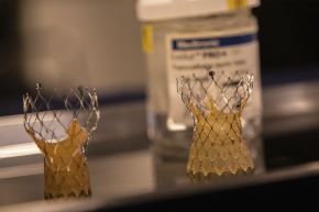 El implante de válvula aórtica transcatéter (TAVI) permite tratar la estenosis aórtica severa sin necesidad de cirugía a corazón abierto. Con este objetivo, la empresa de tecnología médica Medtronic desarrolló la válvula Evolut.